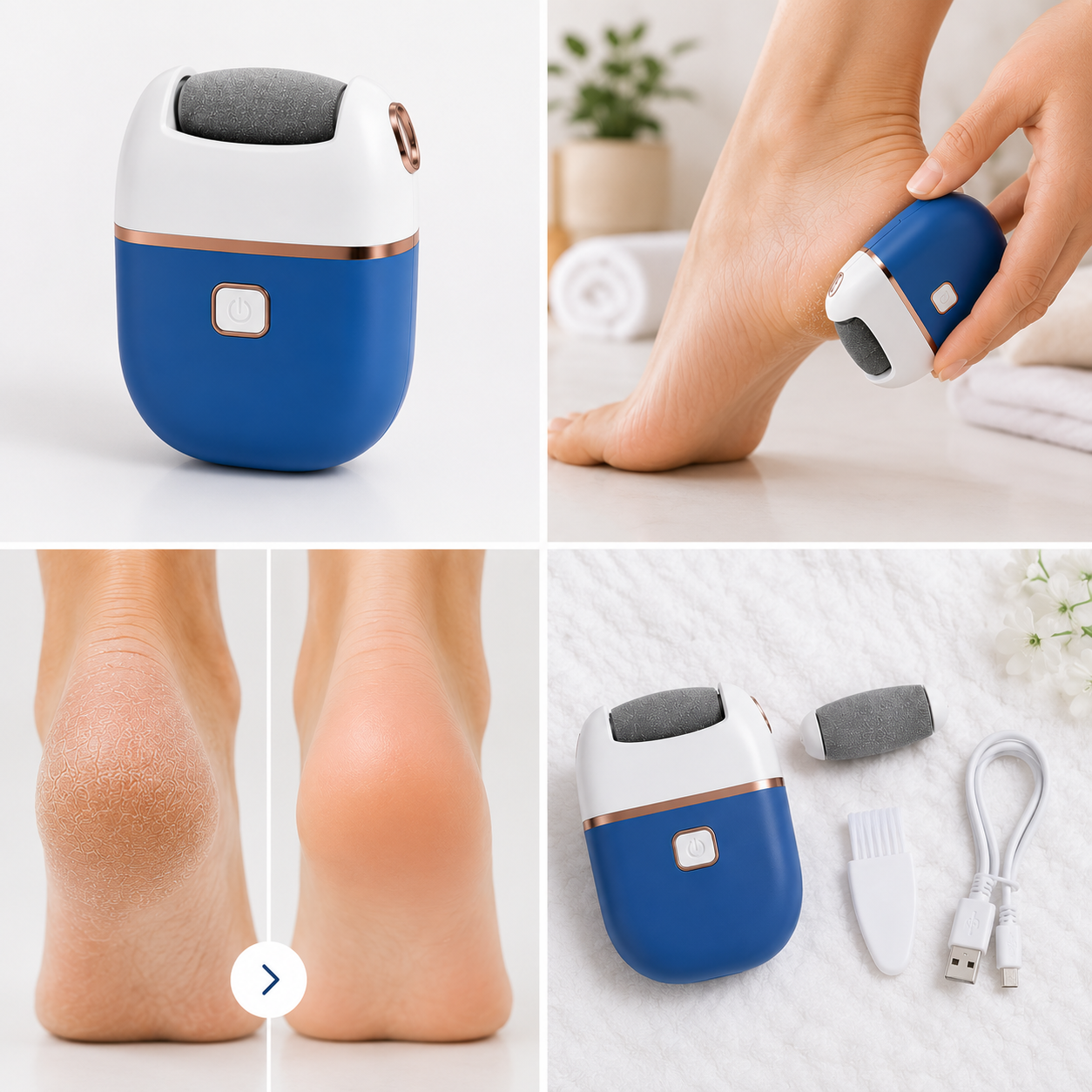 SoftFeet™ – Cuidado Elétrico para os Pés
